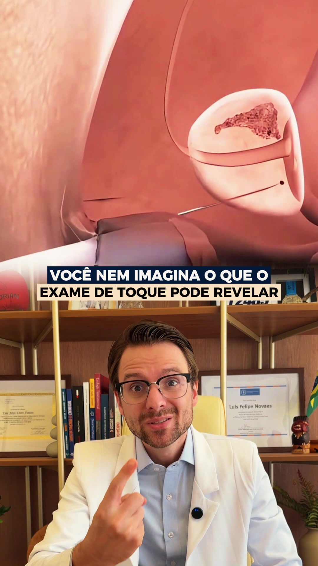 reposicao hormonal - Video 48
