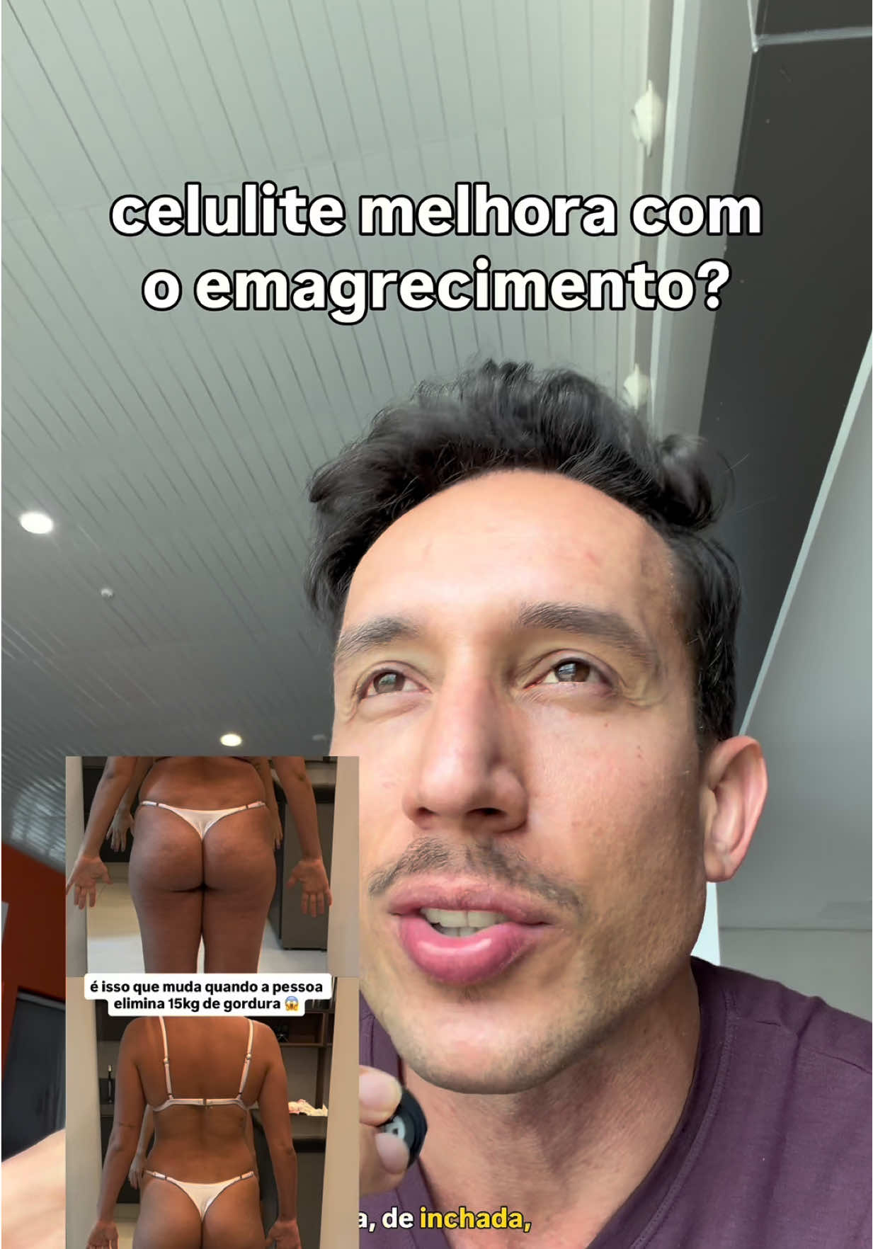 emagrecimento - Video 105