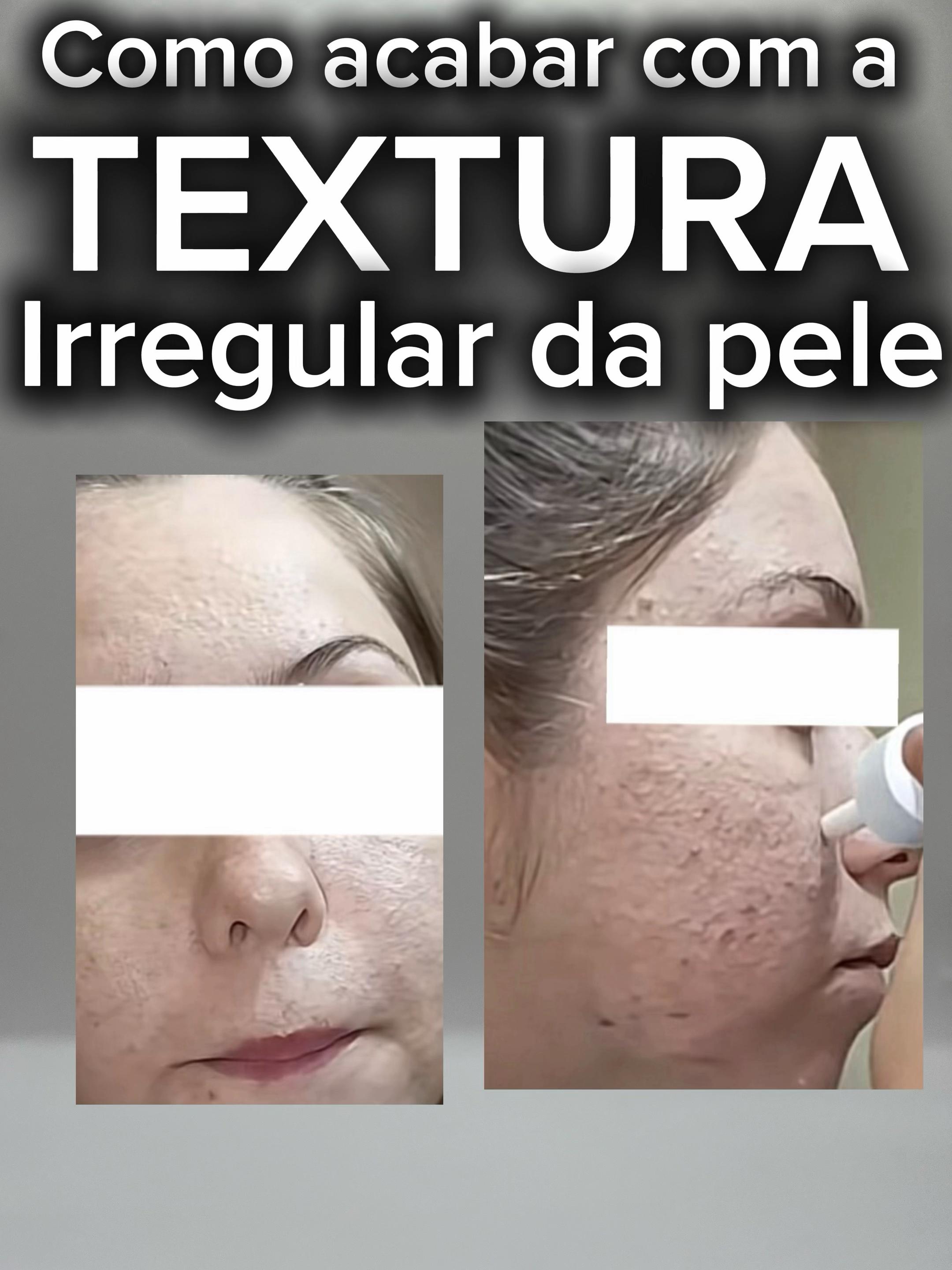 Beleza - Video 19