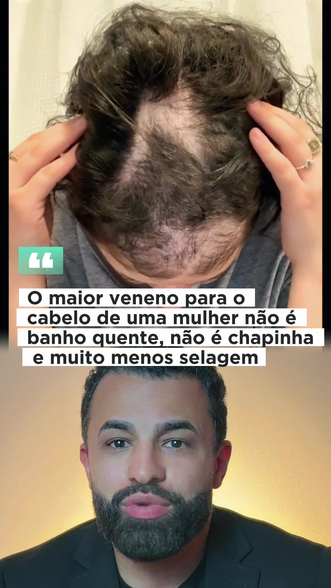 dr.marcelo.santos - Video 54