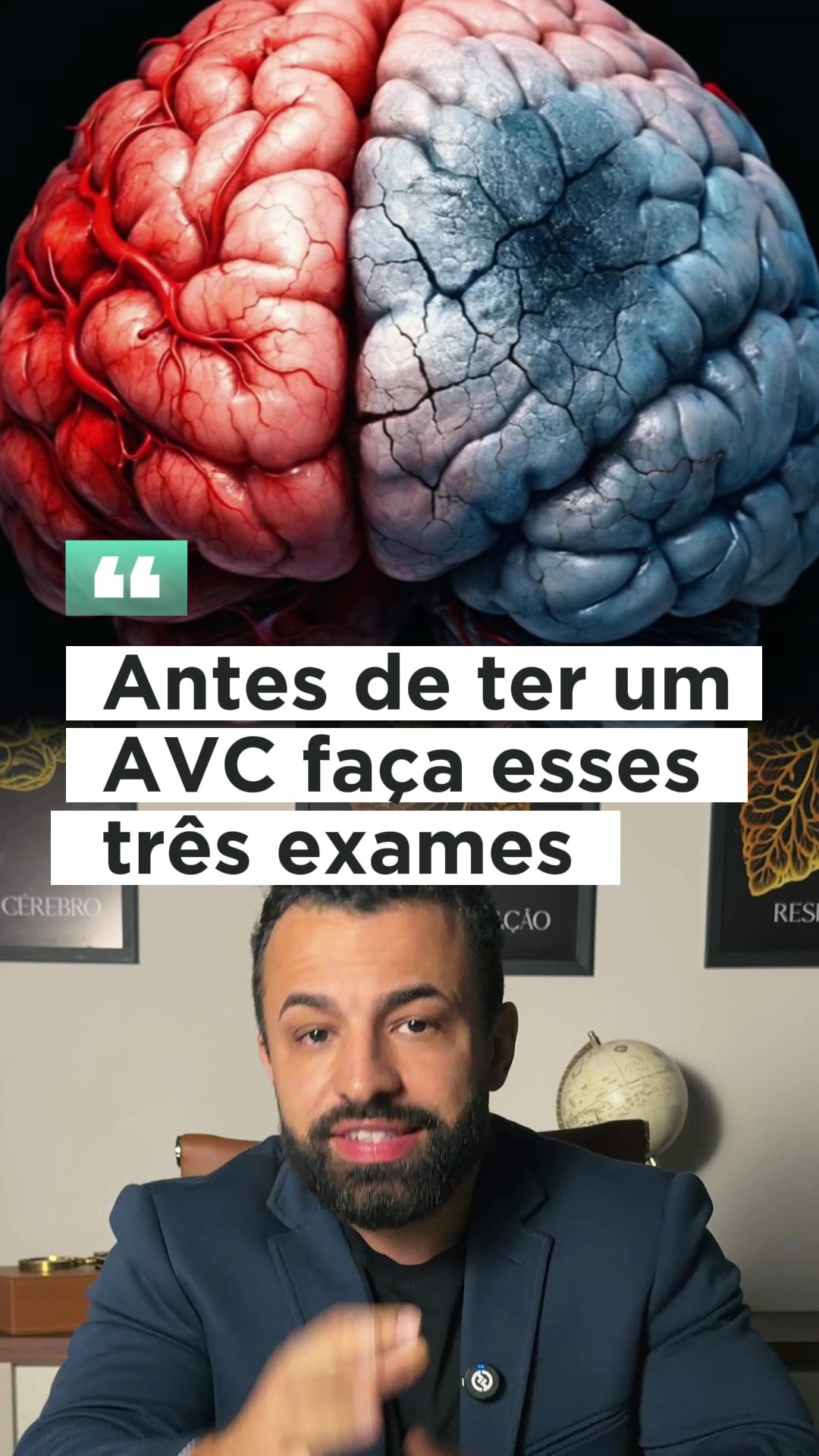 dr.marcelo.santos - Video 31