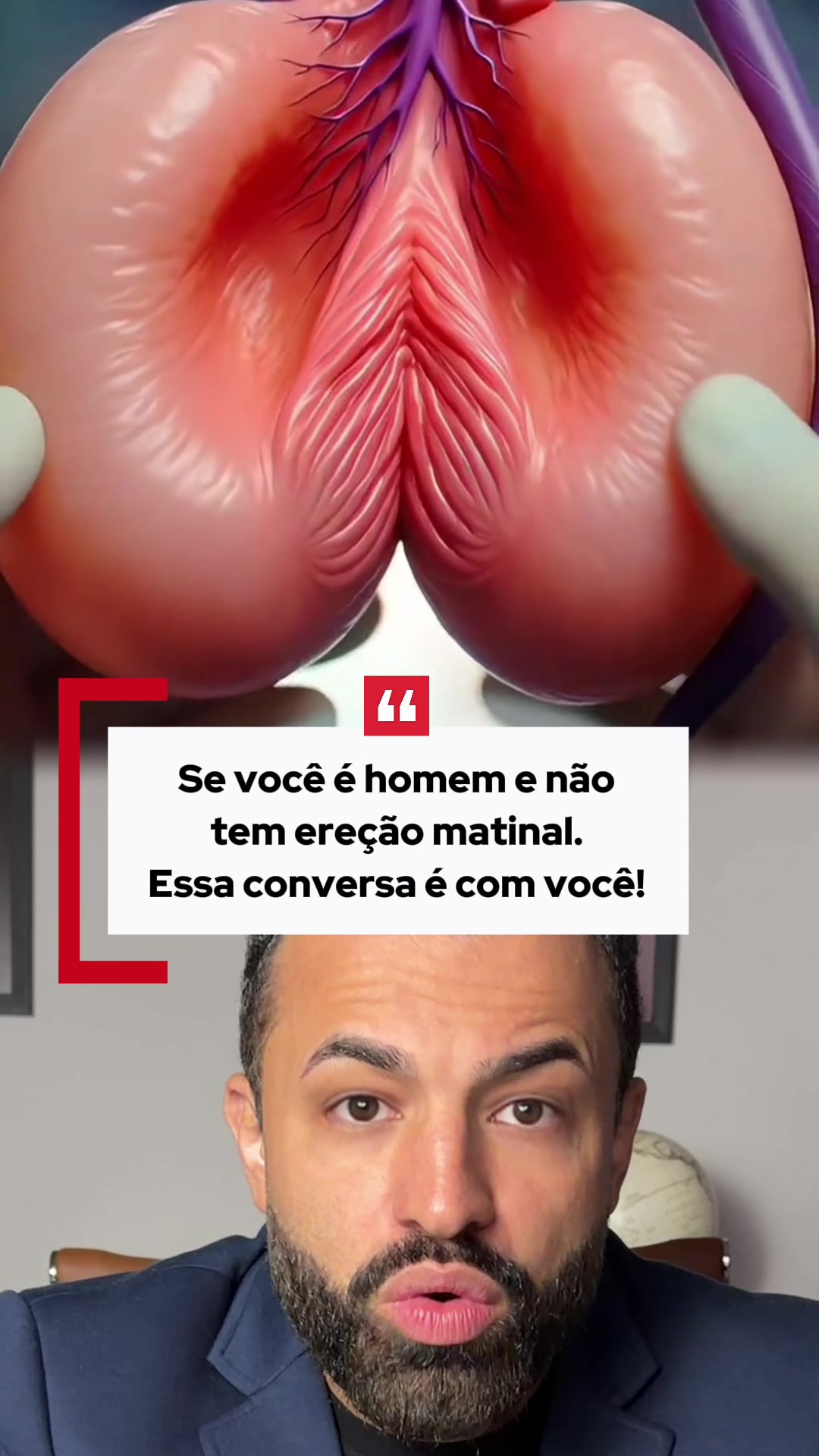 dr.marcelo.santos - Video 46